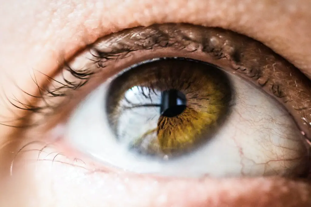 What is the most common eye color in caucasian?
