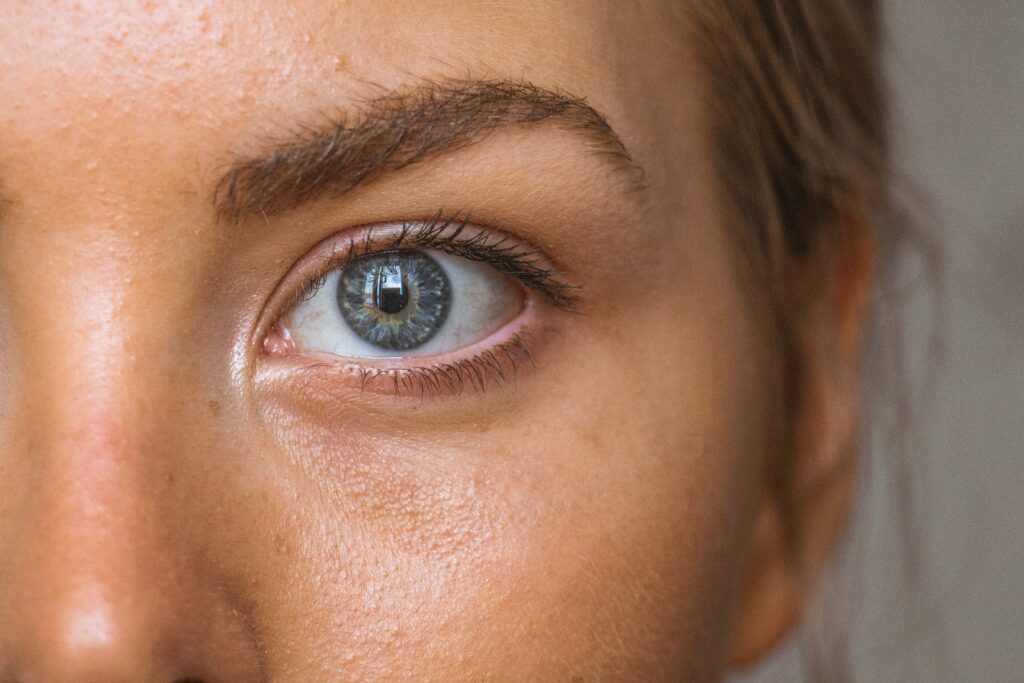 Can scabies get in your eyes?