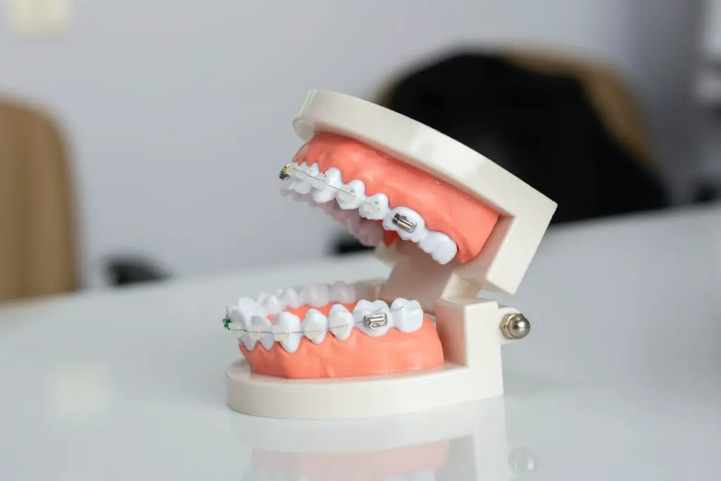 How Long does it take Elastics to shift Teeth?