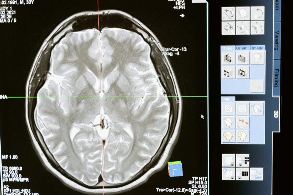 Is a Brain pink or grey?