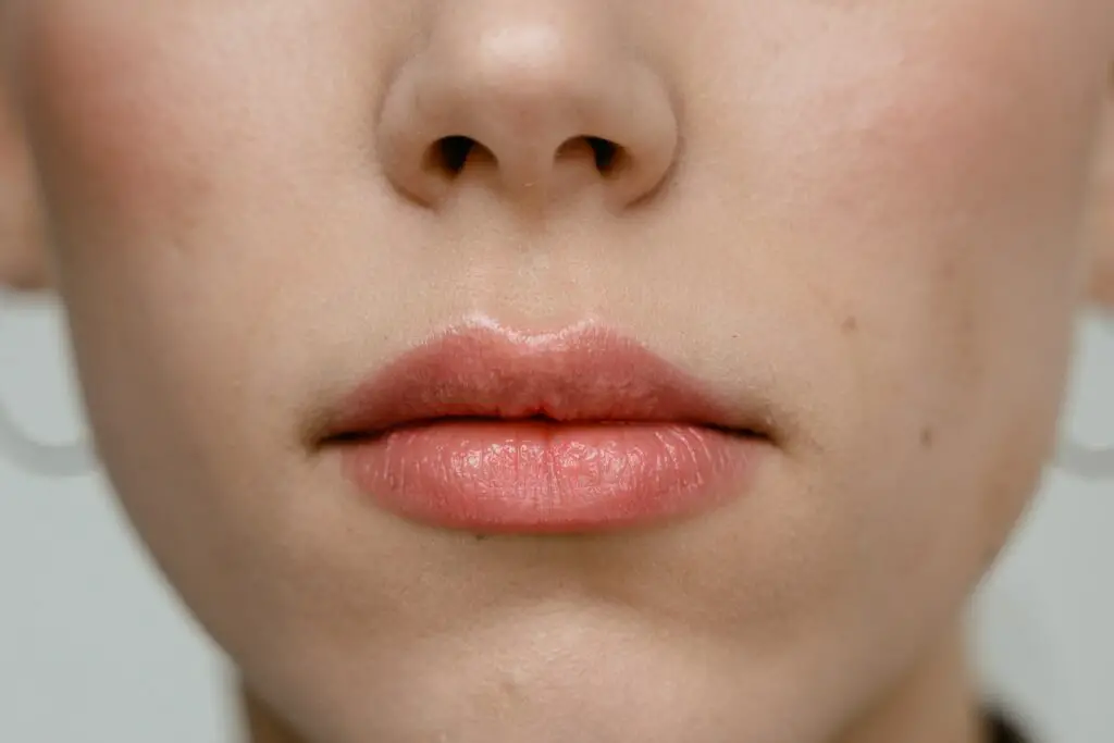 What causes Pink lips?